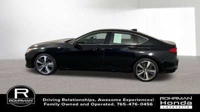 2025 Acura TLX Technology Package